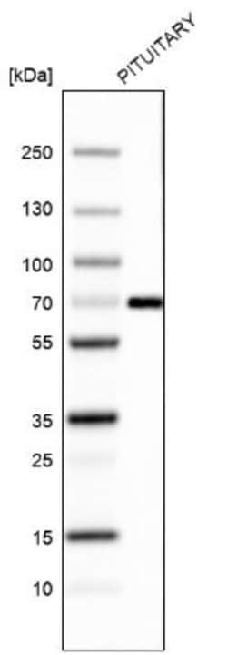 ZNF10 Antibody (CL9744), Novus Biologicals 100 &mu;L; Unconjugated:Antibodies,